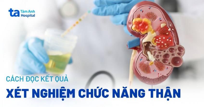 Các bệnh lý thận liên quan đến kết quả xét nghiệm ure máu