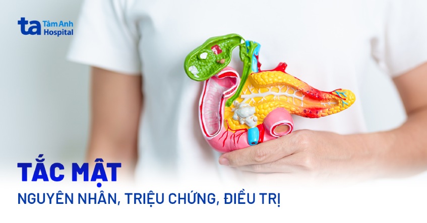 Triệu chứng của rỉ mật: nhận biết sớm các dấu hiệu nguy hiểm